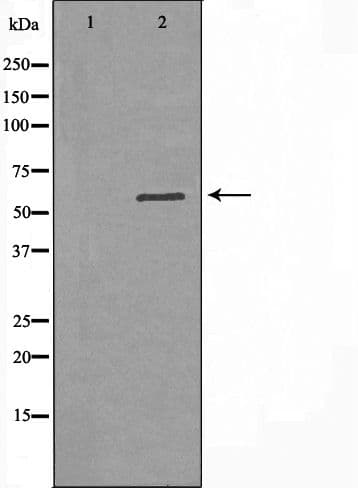 DGKE / DGK Epsilon Antibody
