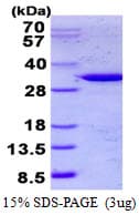 Human TULP1 Protein (Recombinant His)