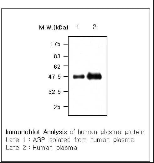 IHC-plus™ ORM1 / Orosomucoid Antibody