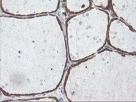 ERBB2 / HER2 Antibody (aa676-1255, clone OTI4F6, Carrier-free)