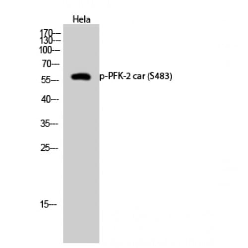 PFKFB2 Antibody (420-500 aa)