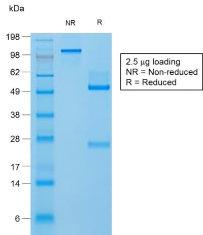 Recombinant Monoclonal Rabbit anti-Human FLG / Filaggrin Antibody (clone FLG/1957R, Azide-free,Carrier-free, aa 198-288, IHC)