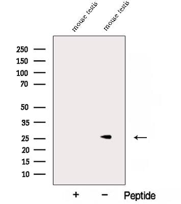 Polyclonal Rabbit anti-Human NAA11 / ARD1B Antibody (WB)