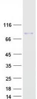 Human GYS2 Protein (Recombinant Myc-DDK (Flag))
