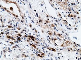 EPM2AIP1 Antibody (clone OTI2G3)