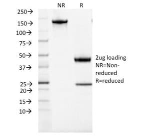 ACTH Antibody (clone CLIP/1407)