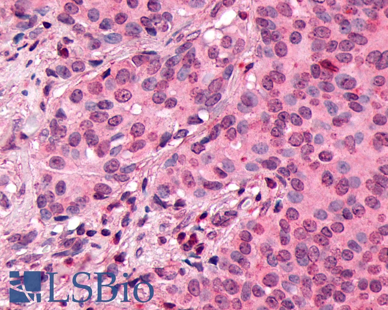 PathPlus™ SSTR3 Antibody (C-Terminus)