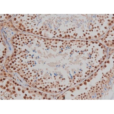 IGF1R / IGF1 Receptor Antibody (phospho-Tyr1346)