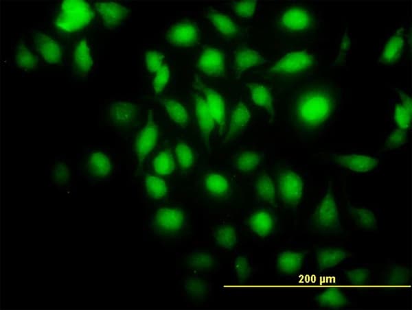 IHC-plus™ BAG1 / BAG-1 Antibody (clone 2D3)