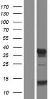 Human C11orf63 Protein (Over-Expression Lysate Myc-DDK (Flag))