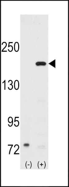 NCOA1 / SRC-1 Antibody (aa186-214)