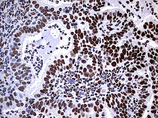 HNRPM / HNRNPM Antibody (aa1-261, clone OTI6H7)