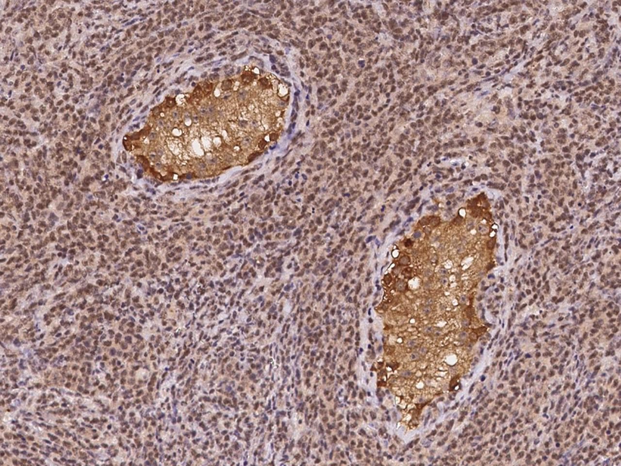 Polyclonal Rabbit anti-Human CT26 / DDX53 Antibody (IHC)