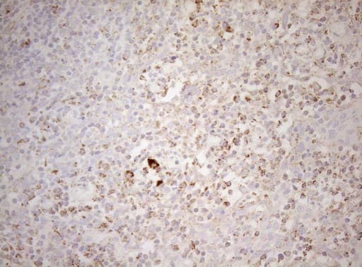 DECR1 Antibody (clone OTI8F11)