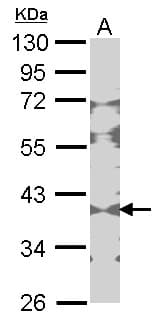 CKB / Creatine Kinase BB Antibody