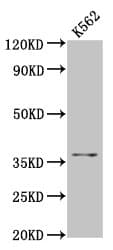FGL1 / Hepassocin Antibody
