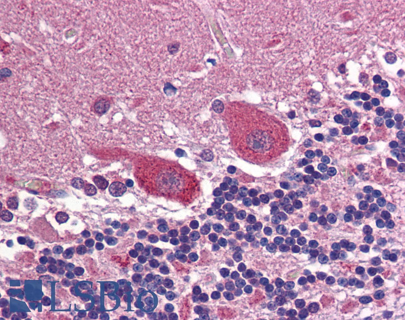 IHC-plus™ HTT / Huntingtin Antibody (aa2703-2911)