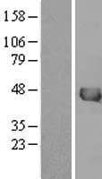 IVD Protein (Over-Expression Lysate Myc-DDK (Flag))
