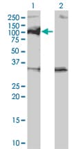 PPM1D / WIP1 Antibody (clone 4D1)