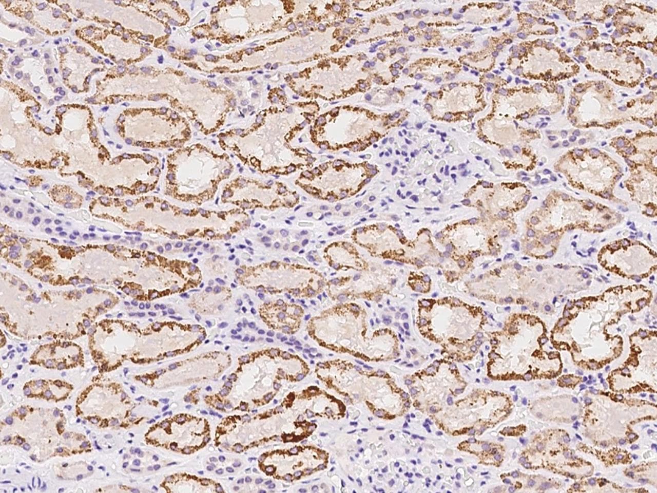 ZFAND2B Antibody