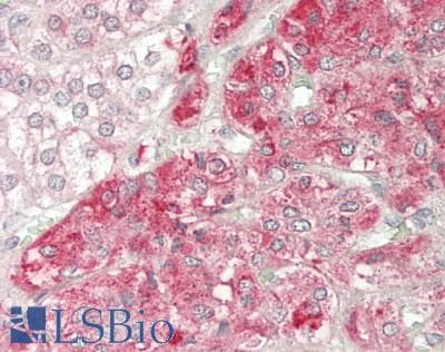 MRAP Antibody (aa7-36)