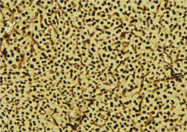 Polyclonal Rabbit anti-Human NDUFA13 / GRIM19 Antibody (IHC, WB)