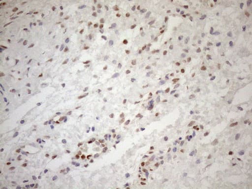 MGMT Antibody (clone OTI6C4)
