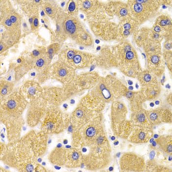 Polyclonal Rabbit anti-Human KIF1B / CMT2 Antibody (IHC, WB)