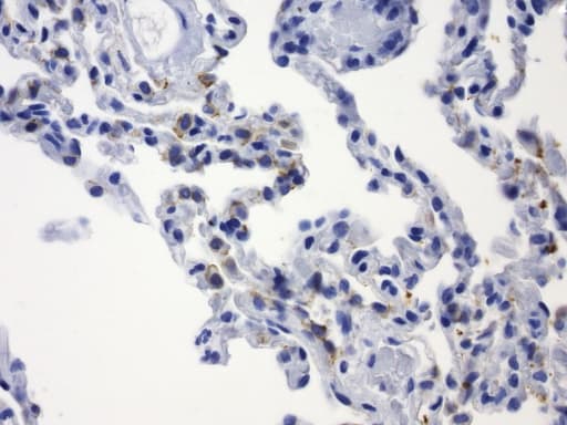 Monoclonal Mouse anti-Human CDH1 / E Cadherin Antibody (clone UMAB184, Carrier-free, IHC, IF, WB)