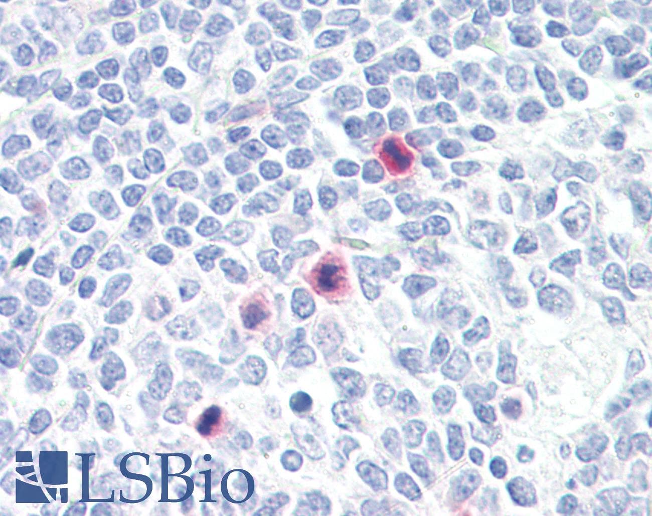 IHC-plus™ Polyclonal Rabbit anti-Human PLA2G4A Antibody (aa471-520, IHC, IF, WB)