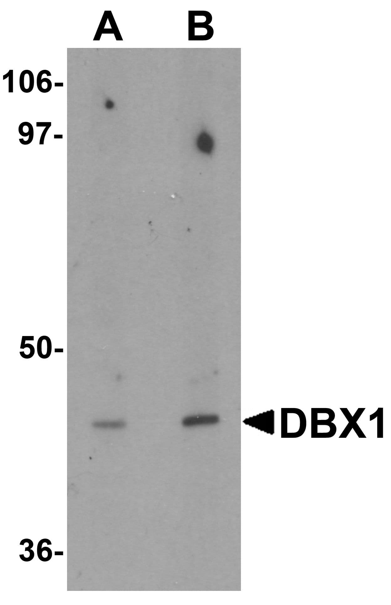 DBX1 Antibody