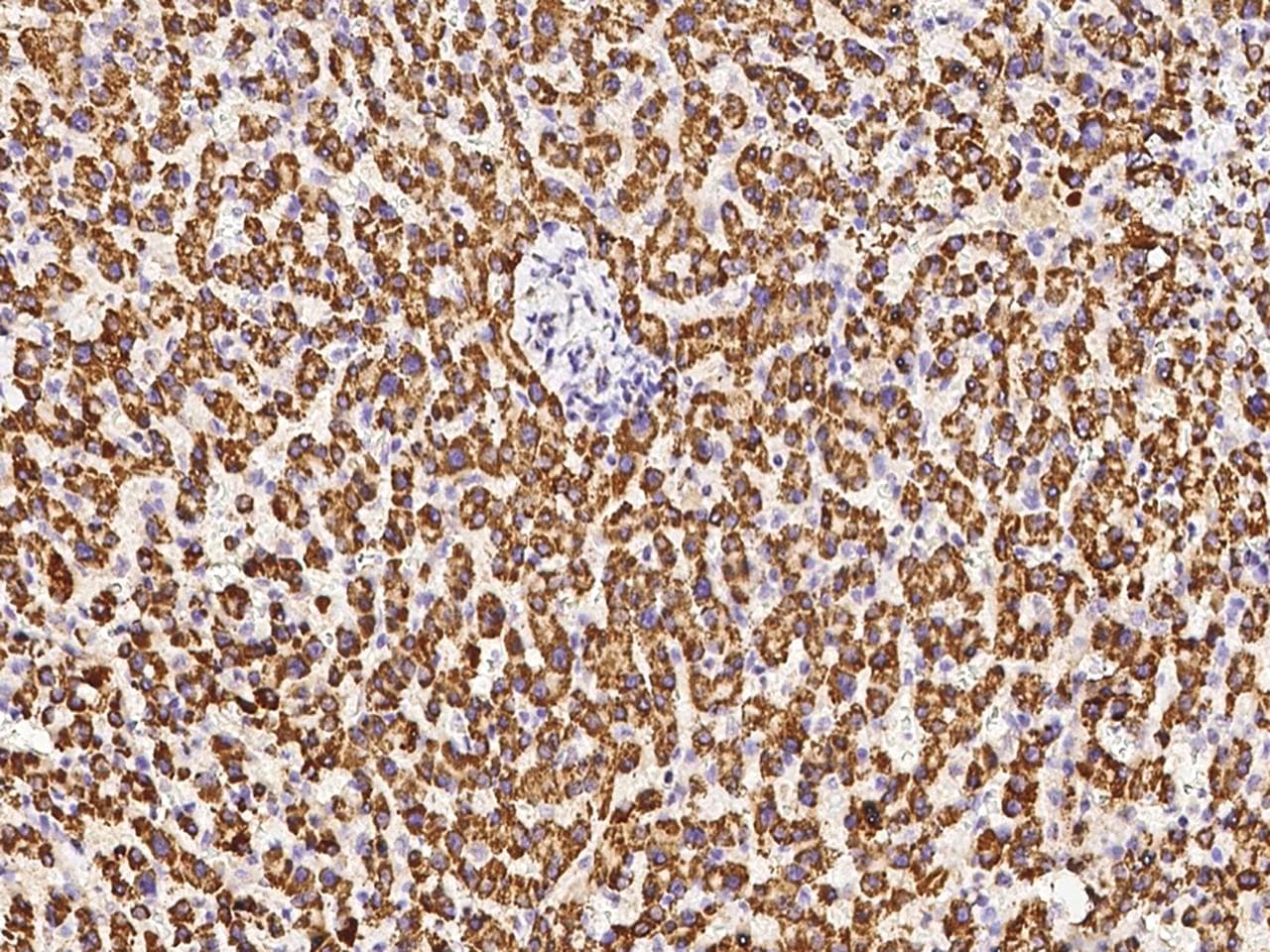 DECR1 Antibody (Preservative Free)