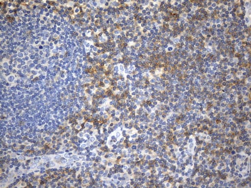 CD99 Antibody (clone UMAB262)