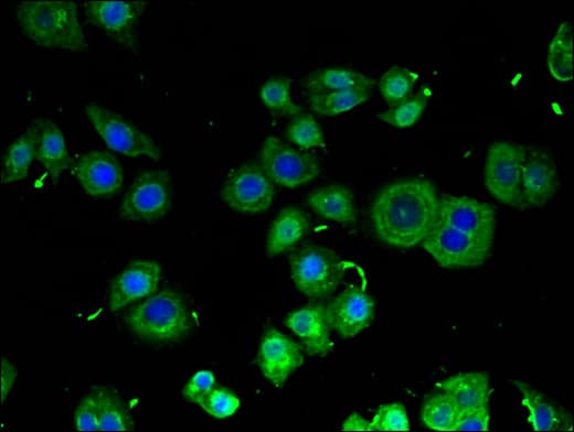 RB1CC1 / CC1 Antibody