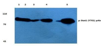 STAT1 Antibody (phospho-Tyr701)