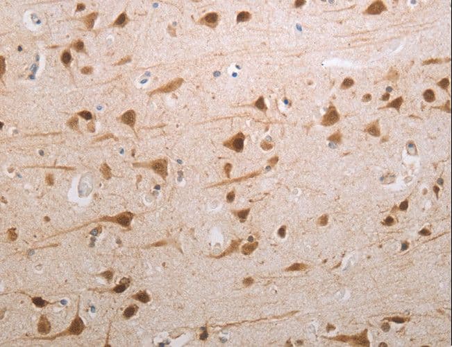 Polyclonal Rabbit anti-Human MDC1 Antibody (IHC)
