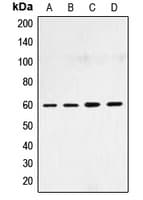 SMAD4 Antibody (N-Terminus)