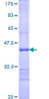 Human UBE2J1 Protein (Recombinant GST, N-terminus)