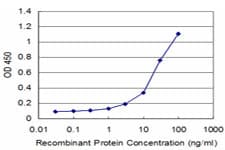 Monoclonal Mouse anti-Human DCPS Antibody (clone 3E5, WB)