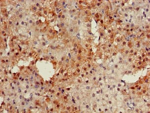 Polyclonal Rabbit anti-Human PKIB Antibody (IHC, IF)