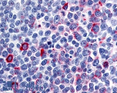 IHC-plus™ CCR8 / CD198 Antibody (N-Terminus)