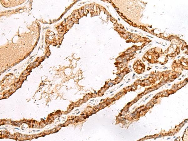 Polyclonal Rabbit anti-Human LGALSL / Galectin 5 Antibody (IHC)