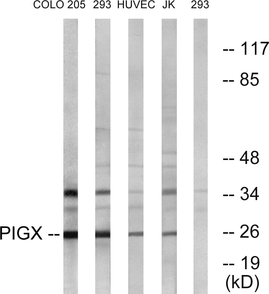 Polyclonal Rabbit anti-Human PIGX Antibody (aa183-232, WB)