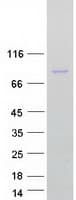 Human Mitofusin 2 / MFN2 Protein (Recombinant Myc-DDK (Flag))
