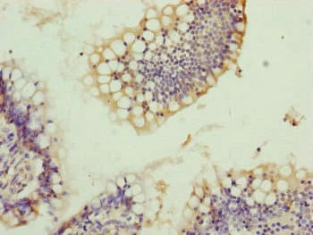 Polyclonal Rabbit anti-Human TRIM10 Antibody (IHC)