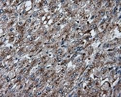 PLEK / Pleckstrin Antibody (clone OTI6H8)