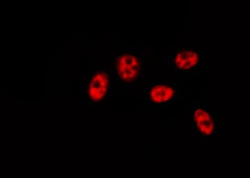 Polyclonal Rabbit anti-Human BRF1 Antibody (IHC, IF, WB)