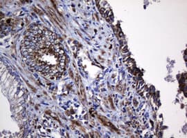 HSPD1 / HSP60 Antibody (clone OTI3G1)