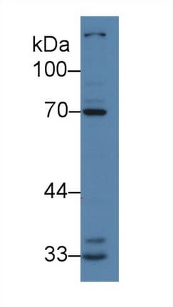 IRAK2 / IRAK-2 Antibody (aa235-521)