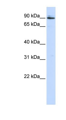 PC5 / PCSK5 Antibody (aa792-841)